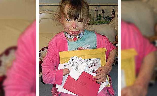 Burn Victim’s Simple Christmas Wish Has Generated A Huge Outpouring Of Support