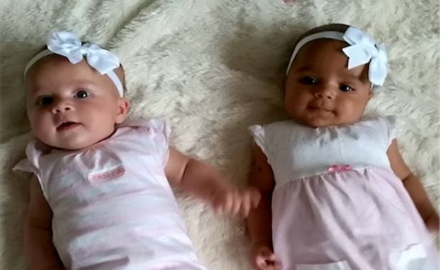 Meet the ‘One-in-a-Millon’ Twins Who Were Born with Two Different Skin Tones