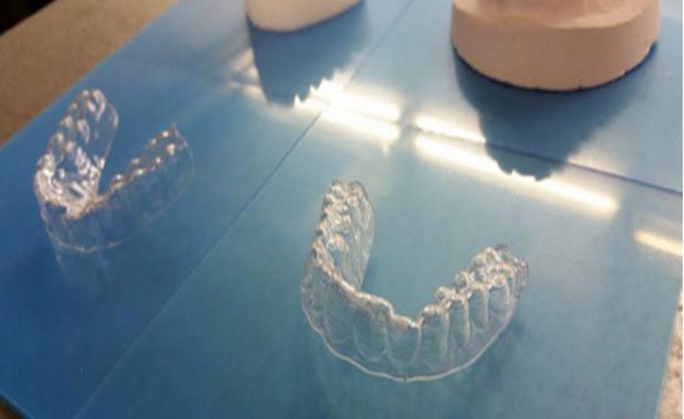 College Student 3D Printed His Own Braces for $60 and Could Change Everything