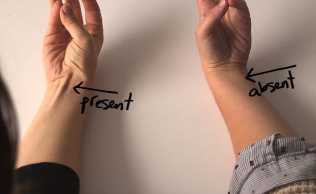 Check Out How You Can Find Your Evolutionary Roots in Your Own Body