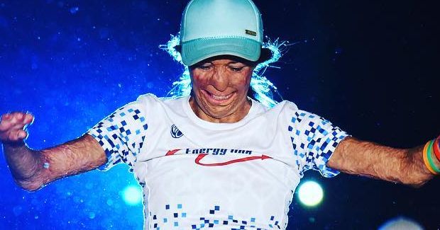 Burn Victim Completes Ironman Triathlon After Being Told She Would Never Walk Again