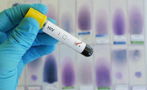 Recent HIV Breakthroughs Bring Us Closer Than Ever to a Vaccine