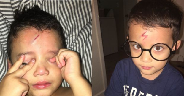 This Mother Turned Her Son Into Harry Potter After He Was Self-Conscious About His Scar