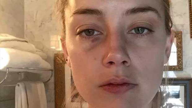 Source: People Magazine