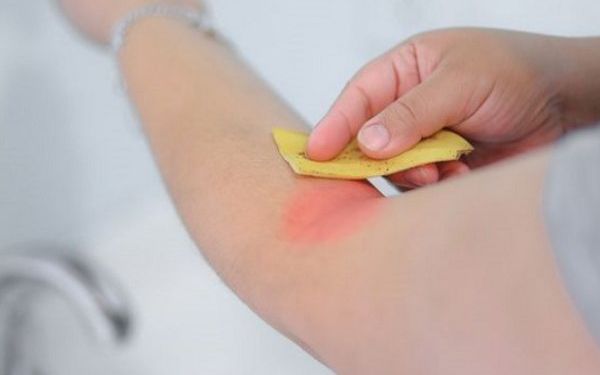 Source: findhomeremedy.com