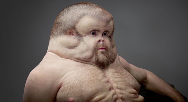 Super-Ribs and a Fatty Head: What Our Bodies Should Look Like To Survive a Car Crash