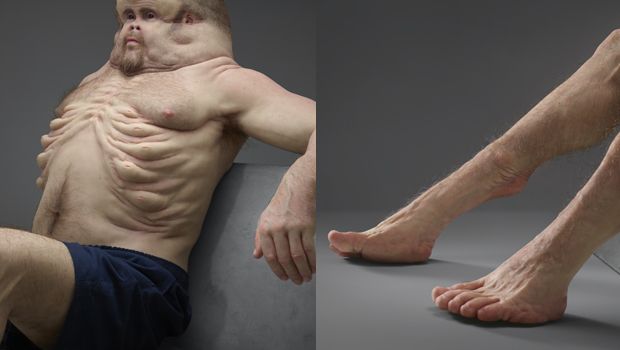 Source: Victoria Transport Accident Commission