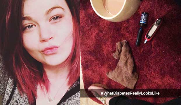 Devastating Facebook Post Reminds Everyone Diabetes Can Be a Dangerous Silent Killer
