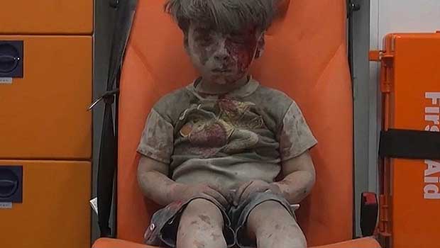 Wounded Syrian Child Captivates the World in Viral Video