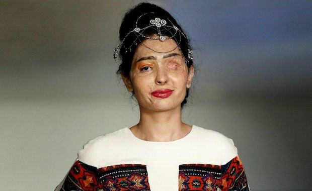 Acid Attack Survivor Gets Amazing Opportunity to Walk the Runway During New York Fashion Week