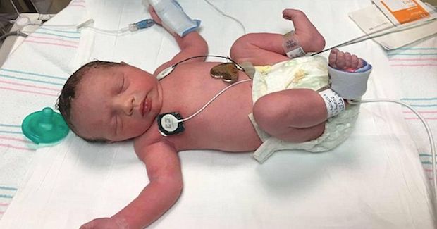 Being Born ‘Twice’ Saved This Little Girl’s Life