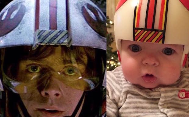 This Baby Had a Skull Defect, so His Dad Designed Absurdly Cute ‘Star Wars’ Helmets