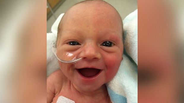 Preemie Inspires Parents With Dazzling Smile 5 Days After Birth