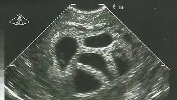 Source: Facebook/Susan Thompson