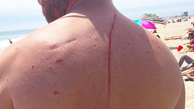 Source: Eugene Finney/CBS Boston