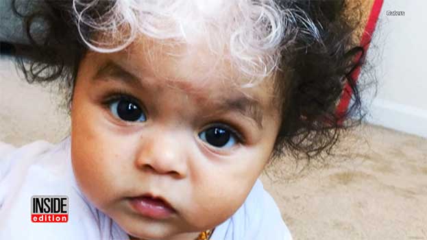 Baby Born With Electric White Hair Streak… Just Like Her Mom, Grandmother, and Great Grandmother
