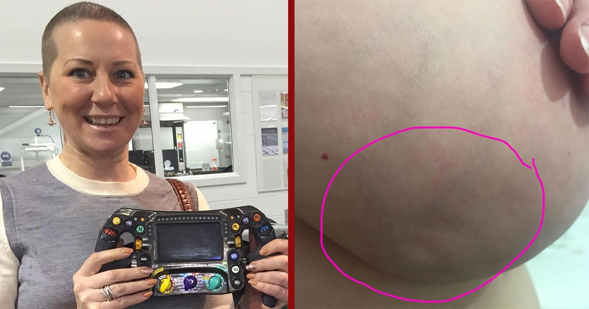 If Not for a Facebook Post, This Woman Might Not Have Detected Her Breast Cancer