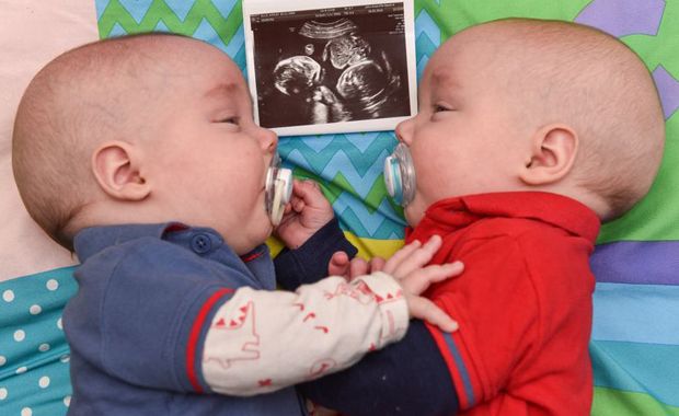 Twins Seen Cuddling in the Womb Are Still Adorably Holding Hands