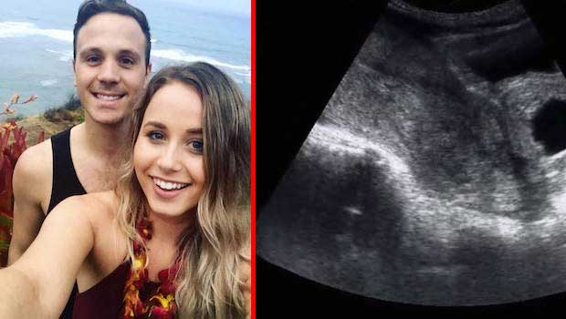 Woman’s Heartbreaking Post on Miscarriage Goes Viral