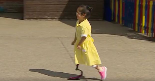 Little Girl Shows Off New Prosthetic Leg in Heartwarming Video