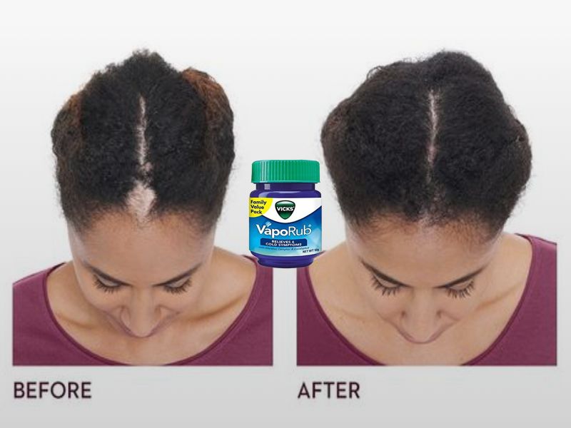Vick's VapoRub Hacks You Probably Didn't Know About Vick's VapoRub Hacks You Probably Didn't Know About