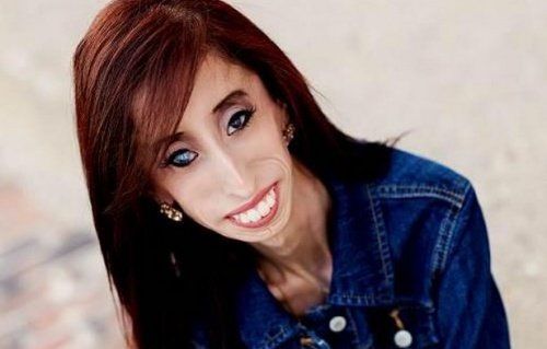 Lizzie Velasquez