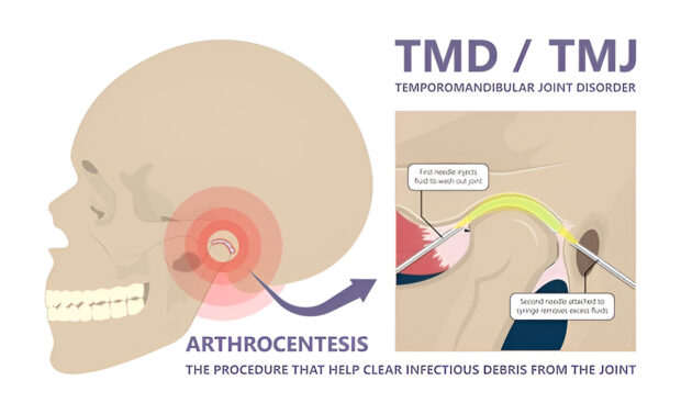 tmd vs tmj