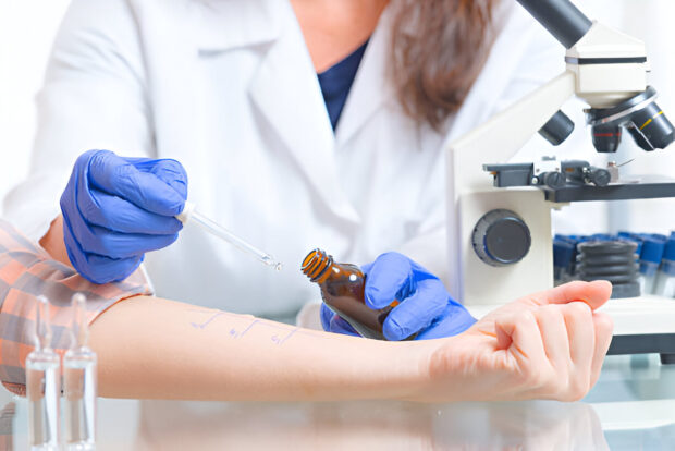 how much does an allergy test cost