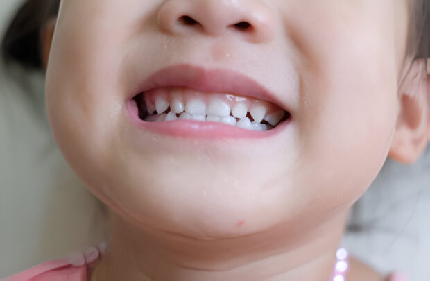 teething in two year olds
